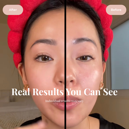 Caléra Facial Drainage Brush